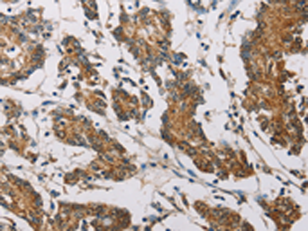Anti-FXYD1 Rabbit Polyclonal Antibody