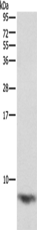 Anti-FXYD1 Rabbit Polyclonal Antibody