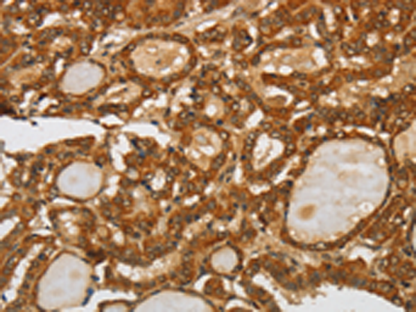 Anti-SPHK2 Rabbit Polyclonal Antibody