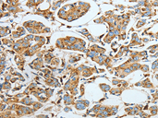 Anti-ASAH1 Rabbit Polyclonal Antibody