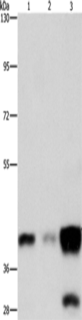 Anti-ASAH1 Rabbit Polyclonal Antibody