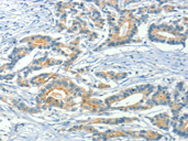 Anti-ASAH2 Rabbit Polyclonal Antibody