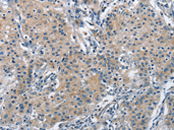 Anti-ASC 1 Rabbit Polyclonal Antibody