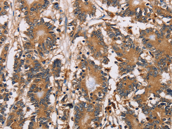 Anti-HTR3C Rabbit Polyclonal Antibody