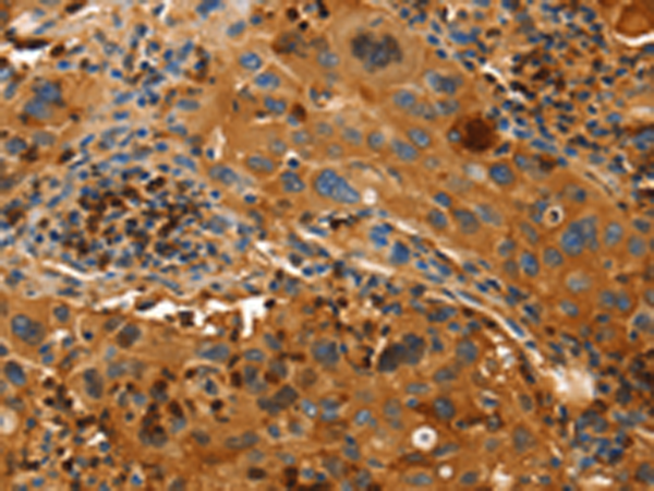 Anti-ORM2 Rabbit Polyclonal Antibody