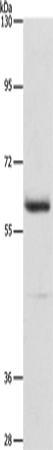 Anti-AIFM3 Rabbit Polyclonal Antibody