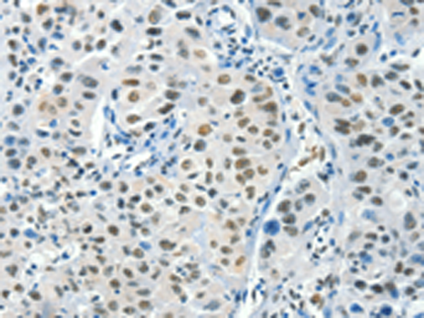 Anti-BCAS2 Rabbit Polyclonal Antibody