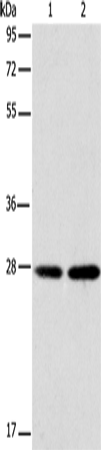 Anti-BCAS2 Rabbit Polyclonal Antibody
