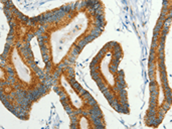 Anti-BCAT2 Rabbit Polyclonal Antibody