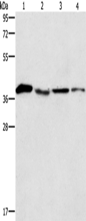 Anti-BCAT2 Rabbit Polyclonal Antibody