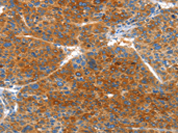 Anti-VWA5A Rabbit Polyclonal Antibody