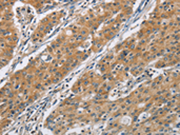 Anti-COPB1 Rabbit Polyclonal Antibody