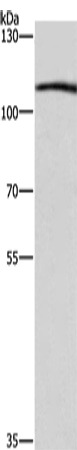 Anti-COPB1 Rabbit Polyclonal Antibody