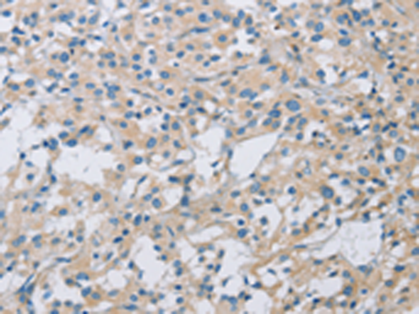 Anti-Maxi Potassium Channel alpha Rabbit Polyclonal Antibody