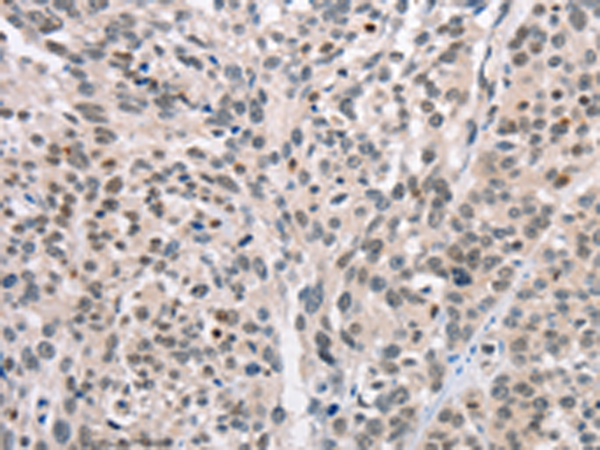 Anti-CABLES1 Rabbit Polyclonal Antibody