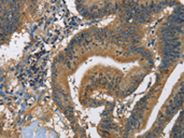 Anti-CAST Rabbit Polyclonal Antibody