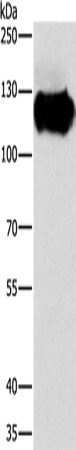 Anti-CAST Rabbit Polyclonal Antibody