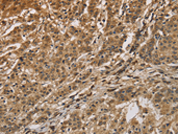 Anti-Calumenin Rabbit Polyclonal Antibody