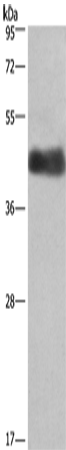 Anti-Calumenin Rabbit Polyclonal Antibody