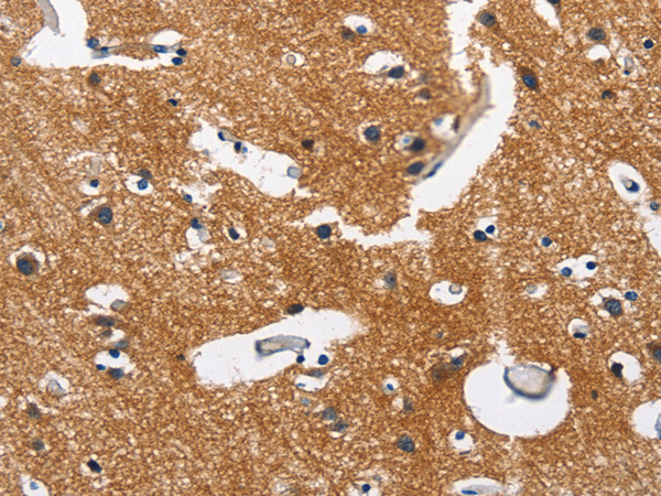 Anti-CAMK1D Rabbit Polyclonal Antibody