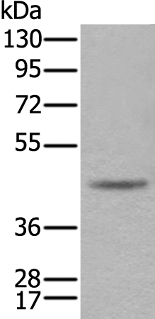 Anti-CAMK1D Rabbit Polyclonal Antibody