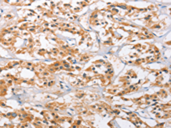 Anti-CAMKIV Rabbit Polyclonal Antibody