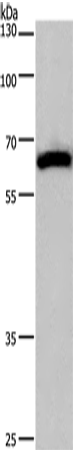 Anti-CAMKIV Rabbit Polyclonal Antibody