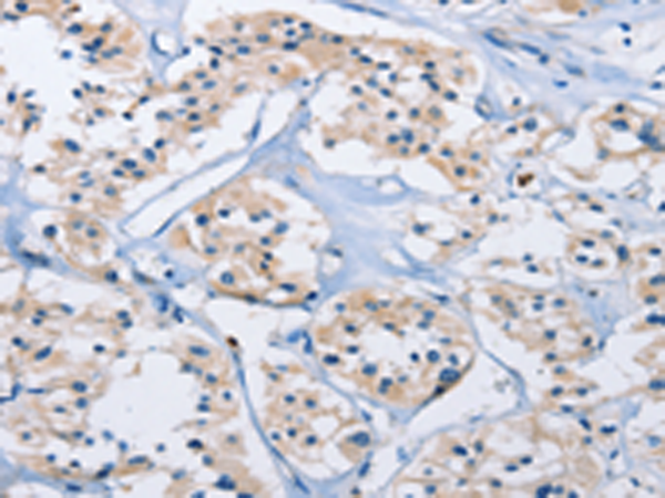 Anti-CARD14 Rabbit Polyclonal Antibody