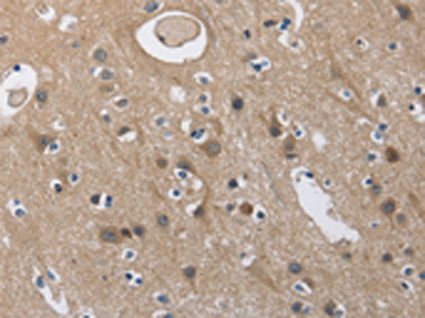 Anti-CD160 Rabbit Polyclonal Antibody