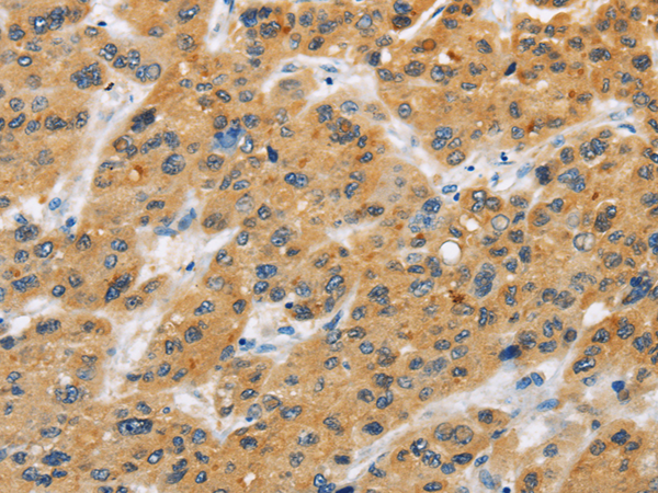 Anti-BTLA Rabbit Polyclonal Antibody