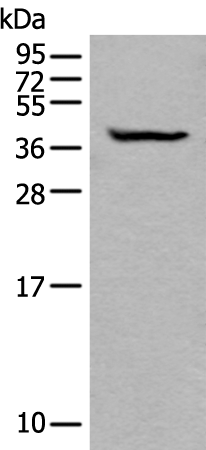 Anti-BTLA Rabbit Polyclonal Antibody