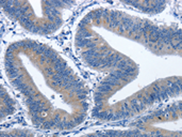 Anti-CDK5RAP3 Rabbit Polyclonal Antibody