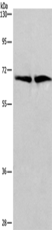 Anti-CDK5RAP3 Rabbit Polyclonal Antibody