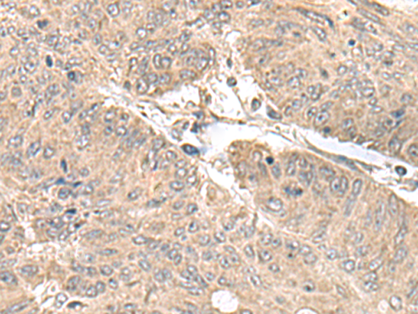 Anti-CENPH Rabbit Polyclonal Antibody