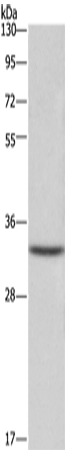 Anti-CENPH Rabbit Polyclonal Antibody
