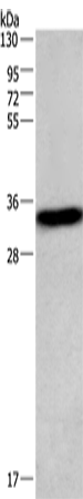 Anti-CENPP Rabbit Polyclonal Antibody