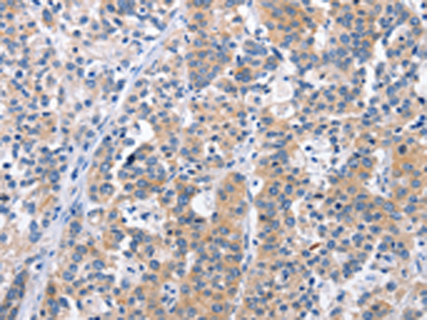 Anti-CEP97 Rabbit Polyclonal Antibody