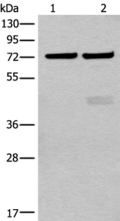 Anti-CETP Rabbit Polyclonal Antibody