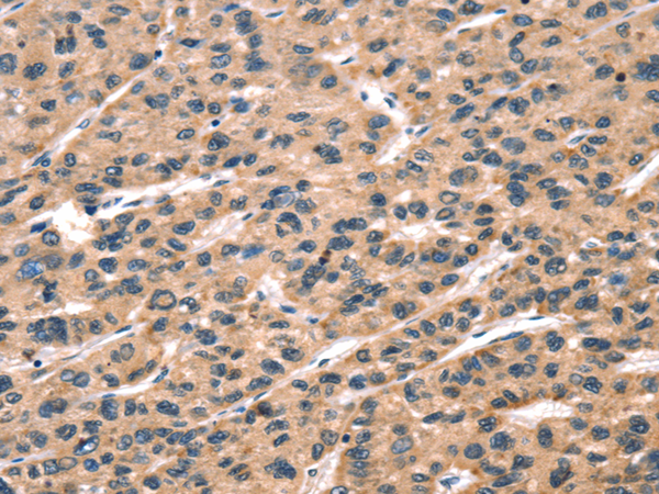 Anti-Glycoprotein Hormones alpha Chain Rabbit Polyclonal Antibody