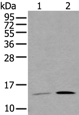 Anti-Glycoprotein Hormones alpha Chain Rabbit Polyclonal Antibody