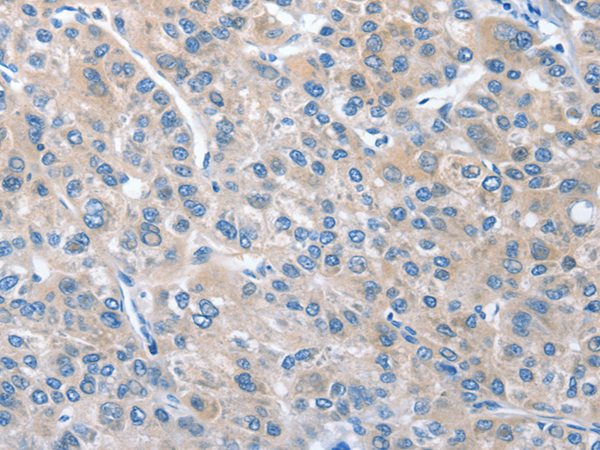 Anti-CGB3 Rabbit Polyclonal Antibody