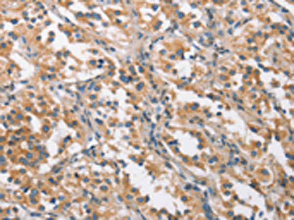 Anti-CHMP1A Rabbit Polyclonal Antibody
