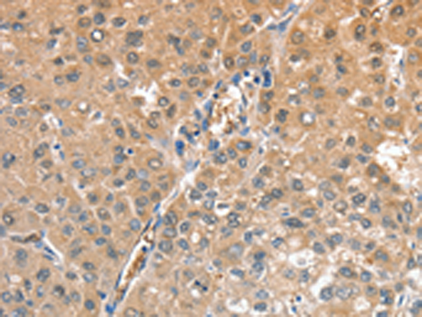 Anti-CIAPIN1 Rabbit Polyclonal Antibody