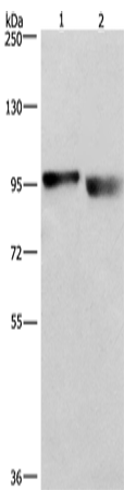 Anti-CIP2A Rabbit Polyclonal Antibody