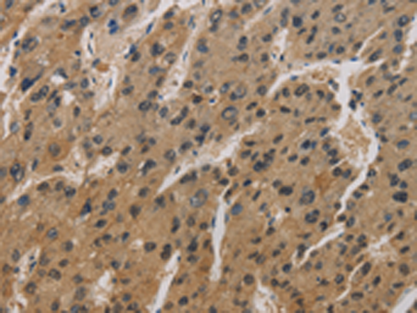 Anti-Coronin 3 Rabbit Polyclonal Antibody