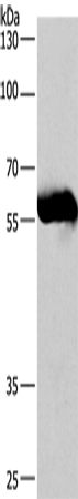 Anti-Coronin 3 Rabbit Polyclonal Antibody