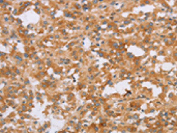 Anti-CRELD2 Rabbit Polyclonal Antibody