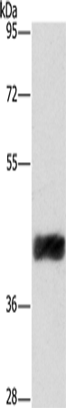 Anti-CRELD2 Rabbit Polyclonal Antibody