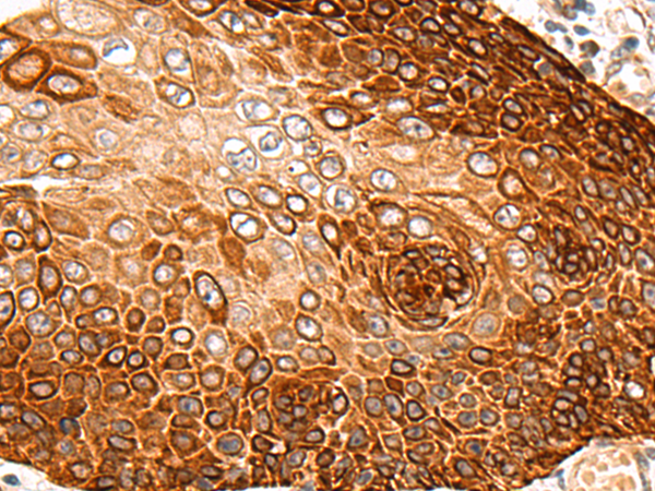 Anti-CROT Rabbit Polyclonal Antibody