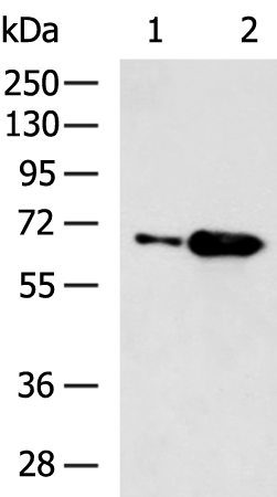Anti-CROT Rabbit Polyclonal Antibody
